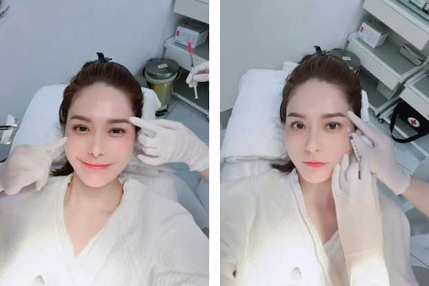 Nữ đại gia quận 7 chi nửa tỷ cấy filler mặt, ngoài đời không &#34;ngán&#34; đọ sắc hoa hậu - 4